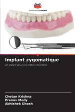 Implant zygomatique af Chetan Krishna