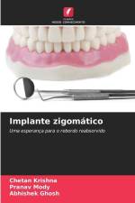 Implante zigomático af Chetan Krishna