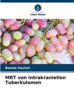 MRT von intrakraniellen Tuberkulomen af Basma Souissi