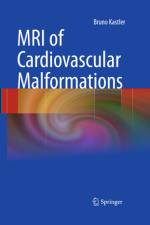 MRI of Cardiovascular Malformations af Bruno Kastler