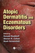 Atopic Dermatitis and Eczematous Disorders af Donald Rudikoff