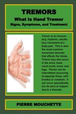 HAND TREMORS - What Is Hand Tremor, Signs, Symptoms, and Treatment af Pierre Mouchette