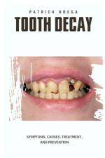 Tooth Decay af Patrick Odega