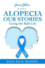 Alopecia af Jamie Elmore