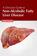 A Clinician's Guide to Non-Alcoholic Fatty Liver Disease af Heidi Hamlin