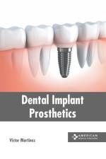 Dental Implant Prosthetics af Victor Martinez