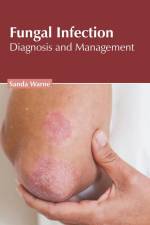 Fungal Infection: Diagnosis and Management af Sanda Warne