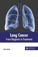 Lung Cancer: From Diagnosis to Treatment af Jute Cassie