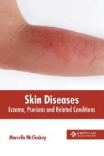 Skin Diseases: Eczema, Psoriasis and Related Conditions af Marcello McCloskey