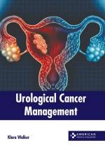 Urological Cancer Management af Klara Walker