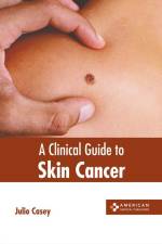 A Clinical Guide to Skin Cancer af Julio Casey
