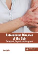 Autoimmune Diseases of the Skin: Pathogenesis, Diagnosis and Management af Deb Willis