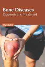 Bone Diseases: Diagnosis and Treatment af Dan Heller