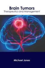 Brain Tumors: Therapeutics and Management af Michael Jones