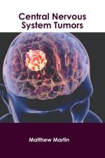Central Nervous System Tumors af Matthew Martin