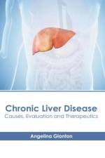 Chronic Liver Disease: Causes, Evaluation and Therapeutics af Angelina Glanton