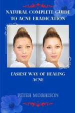 Natural Complete Guide to Acne Eradication af Peter Morrison