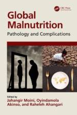 Global Malnutrition af Jahangir (Eastern Florida State College Moini