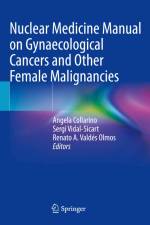 Nuclear Medicine Manual on Gynaecological Cancers and Other Female Malignancies af Angela Collarino
