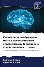 Segmentaciq izobrazheniq mozga s ispol'zowaniem klasterizacii K-srednih w preobrazowanii ottenka af Rajnisha Verma