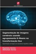 Segmentação de imagens cerebrais usando agrupamento K-Means na transformação Hue af Rajnisha Verma