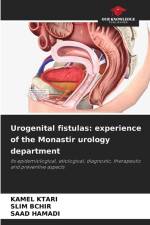 Urogenital fistulas: experience of the Monastir urology department af Kamel Ktari