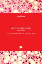 Liver Transplantation af NAGLAA ALLAM
