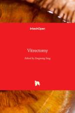 Vitrectomy
