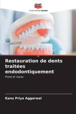 Restauration de dents traitées endodontiquement af Kanu Priya Aggarwal