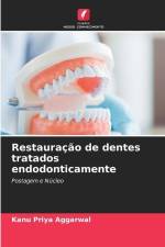 Restauração de dentes tratados endodonticamente af Kanu Priya Aggarwal