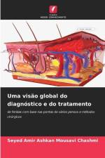 Uma visão global do diagnóstico e do tratamento af Seyed Amir Ashkan Mousavi Chashmi