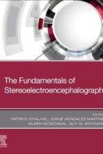 The Fundamentals of Stereoelectroencephalography af Patrick Chauvel
