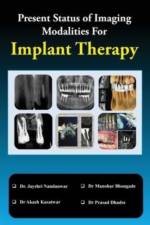 Present Status of Imaging Modalities for Implant Therapy af Jayshri Nandanwar