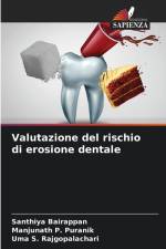 Valutazione del rischio di erosione dentale af Santhiya Bairappan