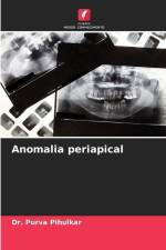 Anomalia periapical af Purva Pihulkar