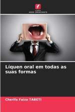 Líquen oral em todas as suas formas af Cherifa Faiza Tabeti