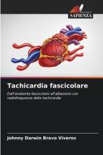 Tachicardia fascicolare af Johnny Darwin Bravo Viveros