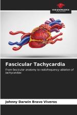 Fascicular Tachycardia af Johnny Darwin Bravo Viveros
