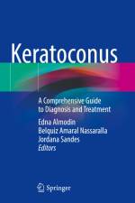 Keratoconus af Edna Almodin