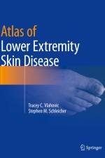 Atlas of Lower Extremity Skin Disease af Stephen M. Schleicher