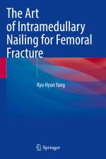 The Art of Intramedullary Nailing for Femoral Fracture af Kyu Hyun Yang
