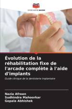 Évolution de la réhabilitation fixe de l'arcade complète à l'aide d'implants af Nazia Afreen