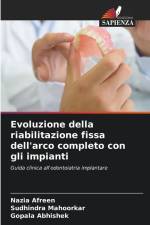 Evoluzione della riabilitazione fissa dell'arco completo con gli impianti af Nazia Afreen