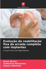 Evolução da reabilitação fixa da arcada completa com implantes af Nazia Afreen