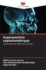 Superposition céphalométrique af Matta Tarun Kumar