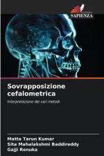 Sovrapposizione cefalometrica af Matta Tarun Kumar