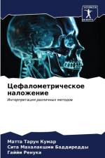 Cefalometricheskoe nalozhenie af Matta Tarun Kumar