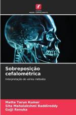 Sobreposição cefalométrica af Matta Tarun Kumar