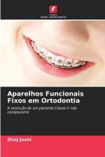 Aparelhos Funcionais Fixos em Ortodontia af Divij Joshi
