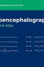Electroencephalography af Luders